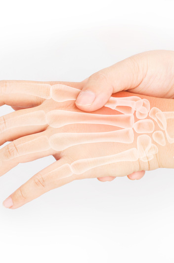 Design of macro, micro and nano-scale implant surface features to optimize bone growth